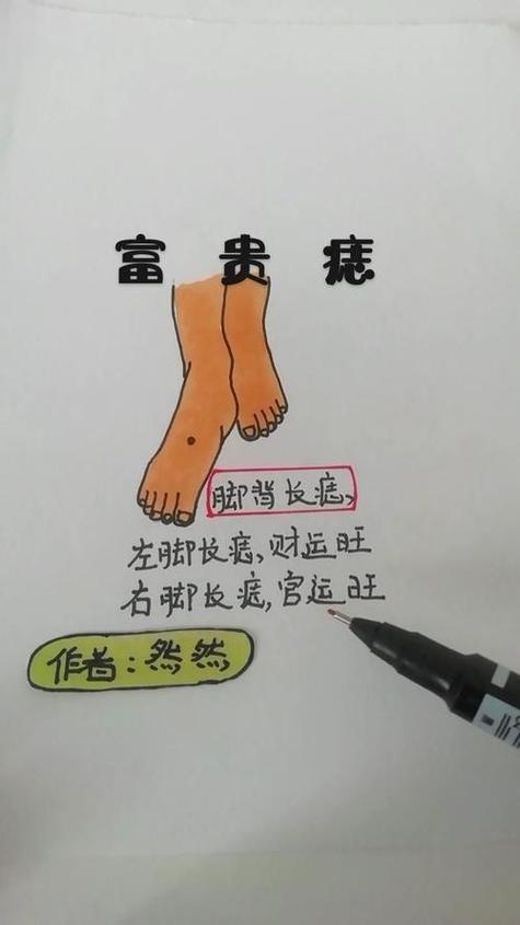 痣相分析 腳背上長痣是菩薩轉世