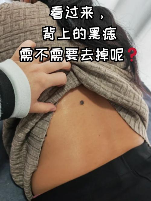 這地方長(zhǎng)黑痣的人走哪都受歡迎，名聲大噪，富貴有余
