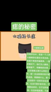 大腿根有痣