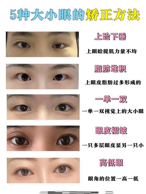 大小眼面相怎么樣