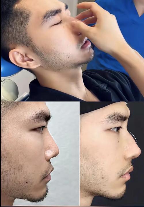 長了駝峰鼻的男人性格 擁有駝峰鼻的人性格固執