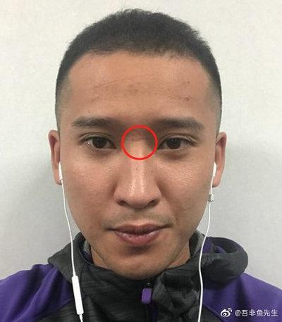 山根斷鼻歪斜的人運(yùn)勢好嗎