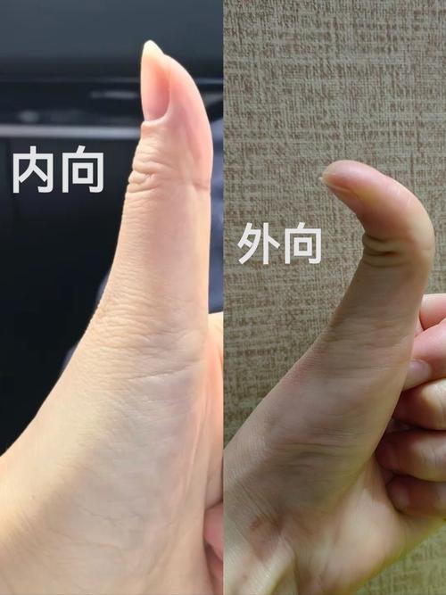 大拇指越彎越聰明是真的嗎