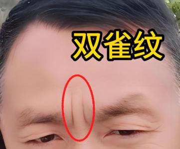 眉間有雙雀紋的男人財(cái)運(yùn)好嗎