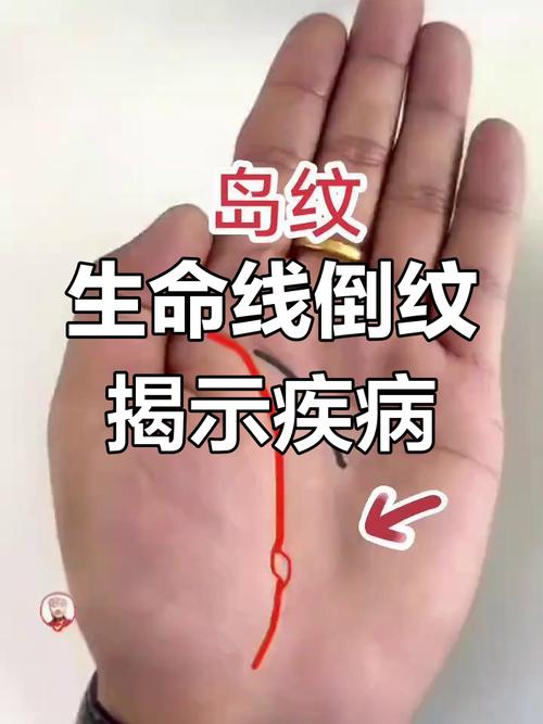 生命線上有島紋的人個性保守，遇事不喜歡出頭？