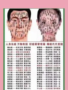 鼻梁上的痣可以去掉嗎