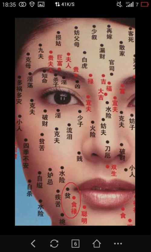 好吃痣長在哪里 可以點掉嗎