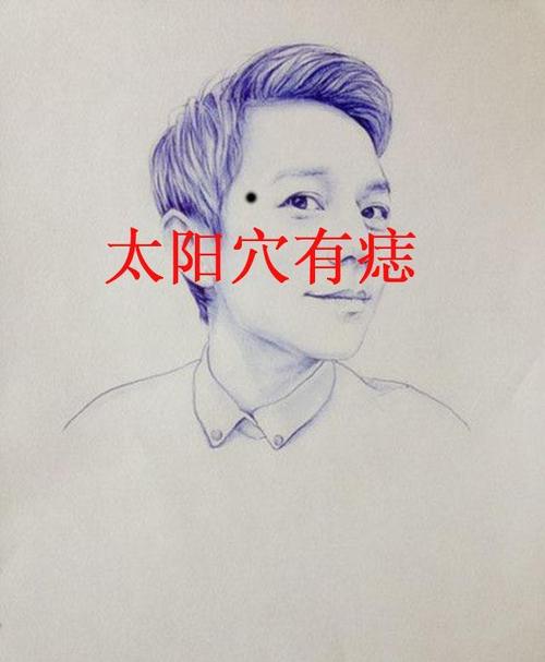 禍害痣長在哪里 眼角太陽穴手指