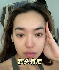 額頭有疤痕的面相，命運會發生怎樣的改變?