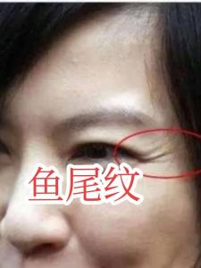 魚尾紋面相看你會(huì)不會(huì)偷情？