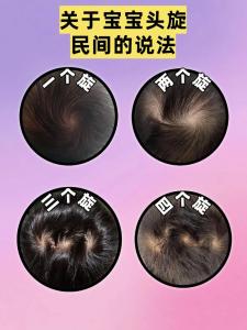 頭上有三個旋在面相學上代表什么