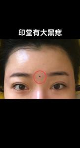 印堂有痣的女人命運如何？夫妻之間情分較淺