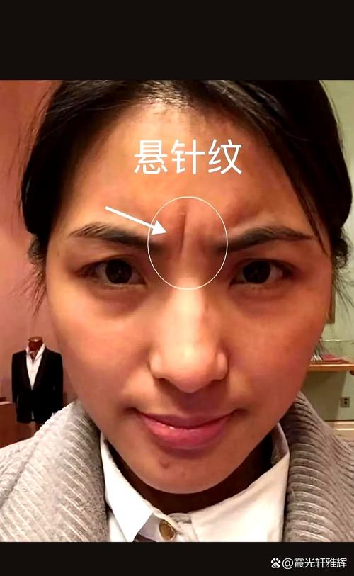 女性懸針紋是什么意思 懸針紋面相女人