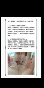 女人婚姻線上有菱形紋意味著婚姻不順？