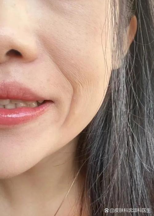 法令紋女人面相  態(tài)度積極而有行動(dòng)力