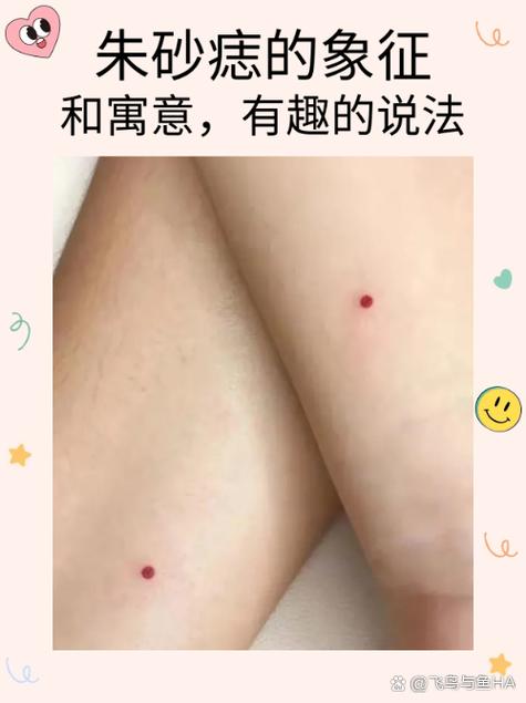 身上朱砂痣代表什么，長在什么地方最好！