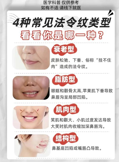 三種法令紋越好命 法令紋深長有威嚴感
