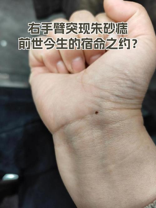 女人右胳膊朱砂痣前世姻緣的位置 手臂內側前緣未了
