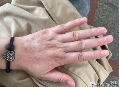手背有肉的人都是富二代嗎