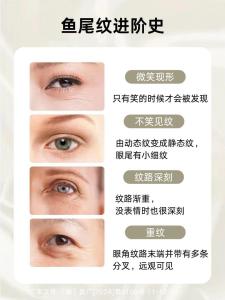 眼角魚尾紋面相 面相學(xué)看魚尾紋有何預(yù)兆