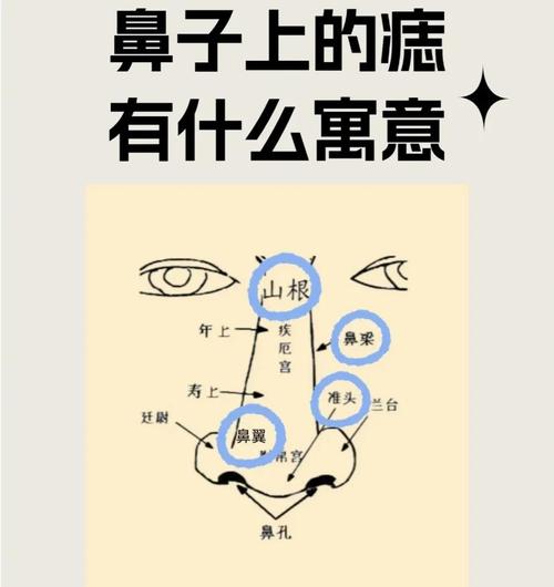 痣相圖解:鼻梁長痣對人的影響