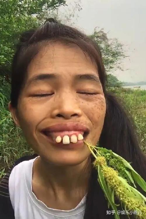 齙牙的女人面相
