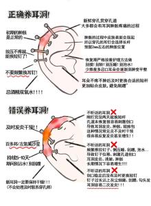 耳洞愈合運氣會回來嗎