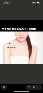 左肩膀上有痣的女人代表什么 右肩膀有痣的女人命運好不好