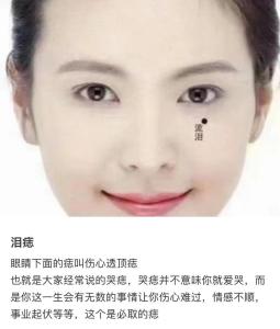 淚堂痣是什么 淚堂有痣代表什么