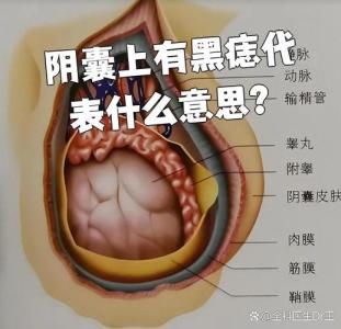 蛋蛋長痣代表什么 男人蛋蛋上有痣代表啥