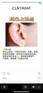 靠近耳朵的臉頰有個痣 臉上有痣代表什么的臉面部黑痣圖解
