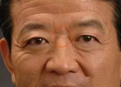 山根有橫紋的人好不好