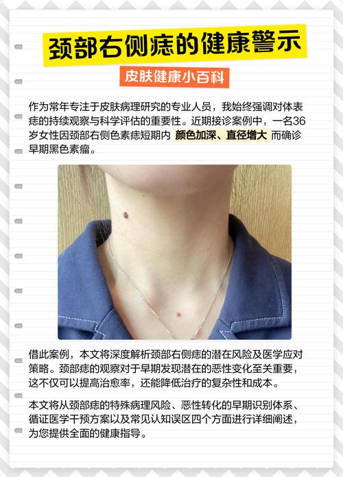 右脖子有痣的女人