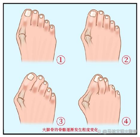 第三個腳趾長是什么命運