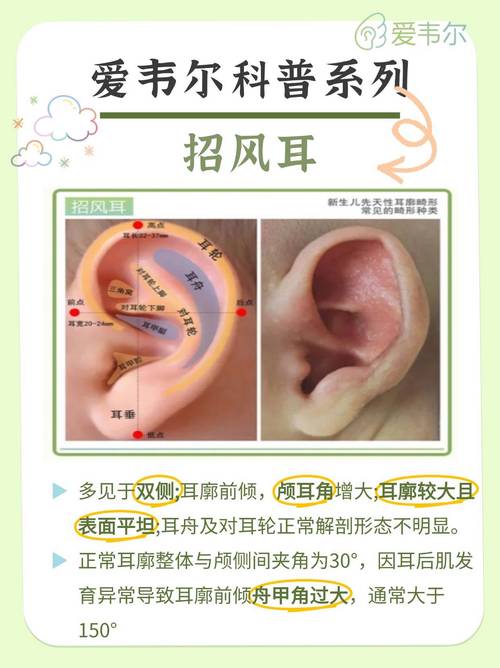 招風耳的人好嗎?招風耳是好還是壞?