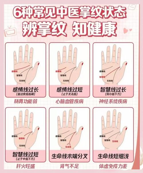 掌紋看健康有科學(xué)依據(jù)嗎