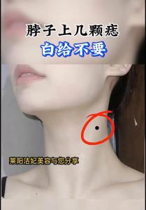 女人脖子上長痣好不好