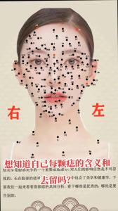 痣的位置不同，有什么寓意嗎