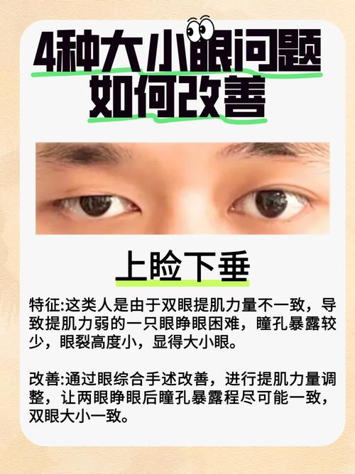 從外觀上看大小眼不好看，那從面相上說，大小眼好不好呢？