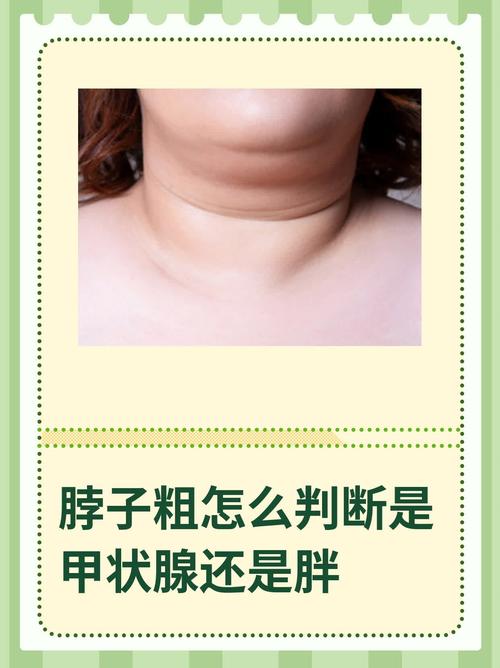 脖子很粗的女人運(yùn)勢(shì)如何