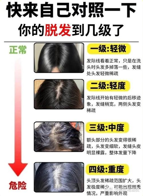 女人頭發稀少運勢解析