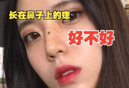 女鼻梁中間有痣