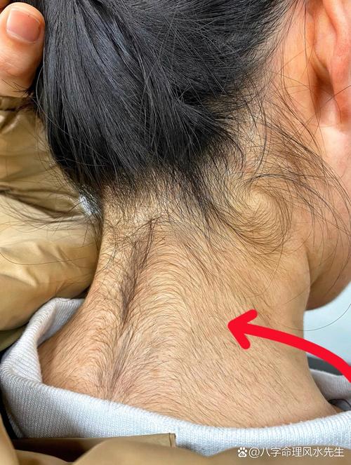 頭發(fā)長到脖子后命運(yùn)