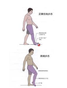 體相學中什么樣的腿型感情容易受挫折