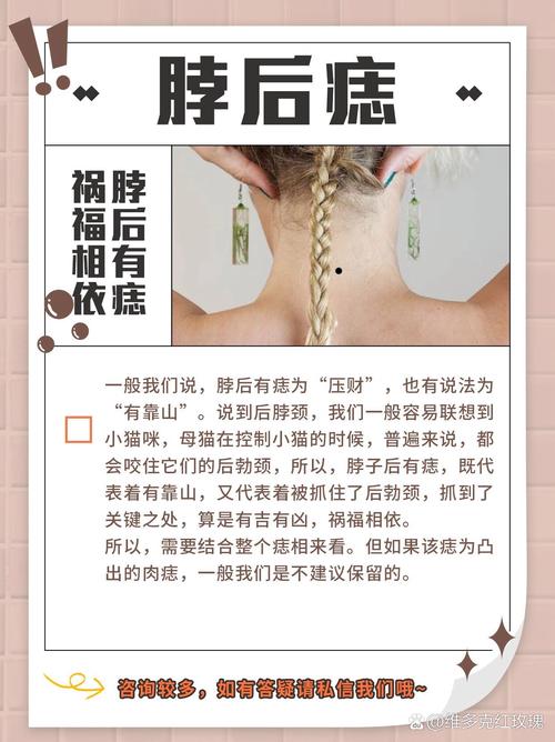 后脖子有痣圖解命運(yùn)如何
