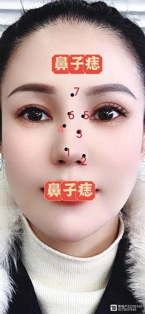 女人鼻尖上長痣