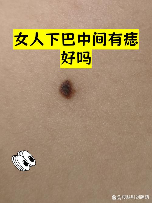 下巴中間長(zhǎng)痣