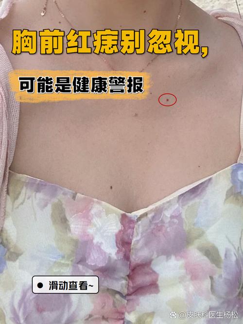 女胸口有朱砂痣