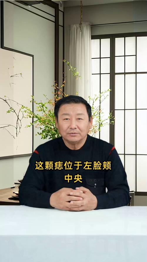 左臉頰有痣