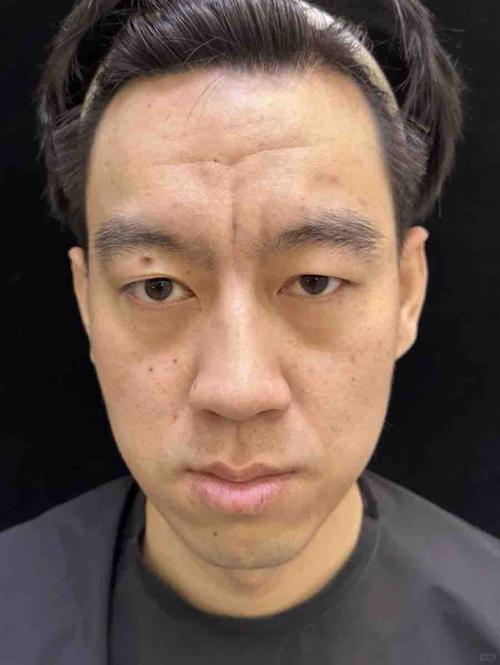 抬頭紋重的男人好嗎？思慮容易過多？
